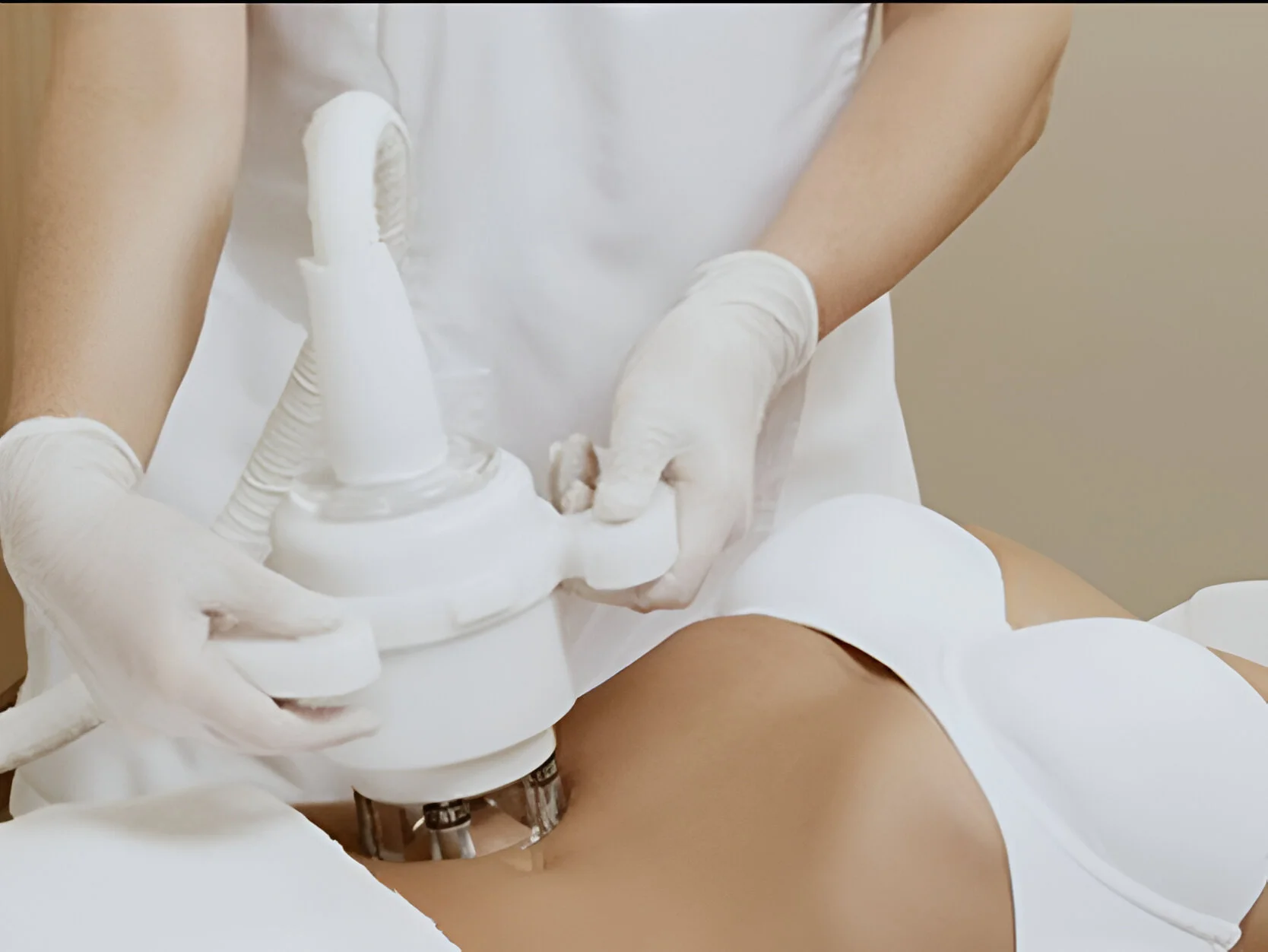 Radiofrequency body treatment