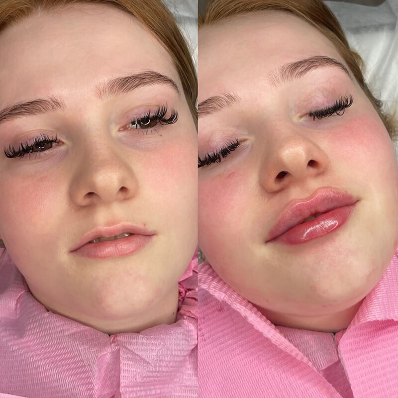 Russian Lips result 4