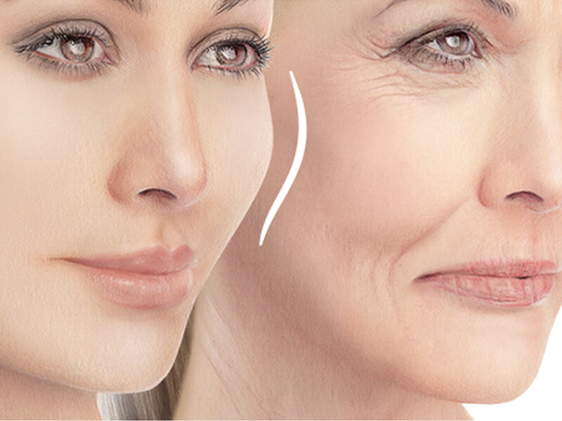 Injectable Wrinkle Fillers 2